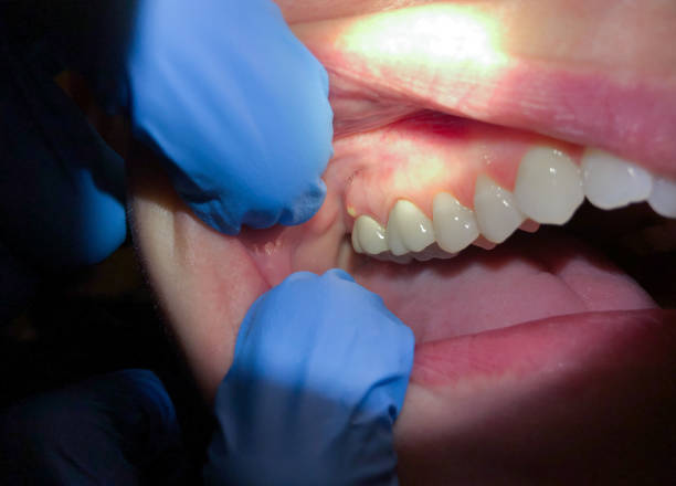 Best Orthodontic Emergency Dentist in Oakland, SC